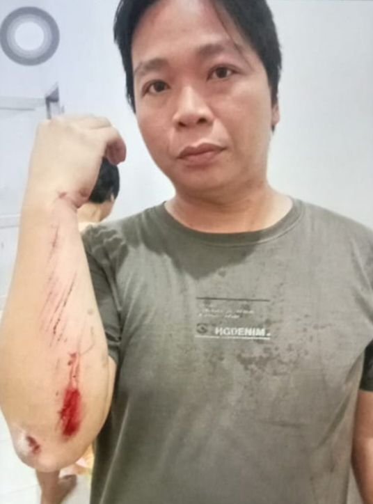 Informasi "Dikunci"..!! Konfirmasi Kasus Penganiayaan, Kanit PPA Polres Tebing Tinggi Bilang Terserah Abanglah..!!
