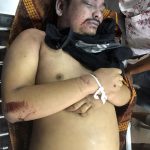 Berangkat Sehat, Pulang Jadi Mayat..!! Rosmiati Surbakti: Anakku Mati Disiksa Oknum Polisi..!!