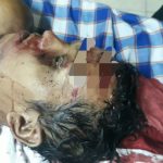 Tabrak Tiang Listrik, Kening Koyak..!! Tumanggor “Menghadap” Pencipta Dunia..!!