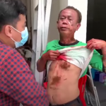Kosmas Penghadang Bom Bunuh Diri Luka-luka..!! Kepala Pelaku Ditemukan di Atap Bangunan Samping Gereja..!!