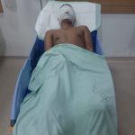 Kekerasan Terhadap Jurnalis Terus Meningkat..!! Wartawan Disiram Air Keras di Medan..!!