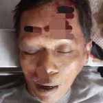 Brakk..!! Disambar Eltor, Ginting Tercampak Lalu Tewas di Tempat..!!