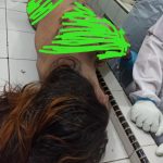 Cemburu..!! Gadis ABG Tewas Disiram Pacar Pakai Air Keras..!!