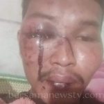 Sadis..!! Warga Patumbak Diculik Lalu Dipukuli..!! Dari Mata Muncrat Darah..!! Dikira Mati Dibuang di Tanah Karo..!!