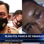 WARGA PATUMBAK DICULIK LALU DIANIAYA..!! KAPOLDASU “GERAM” AKAN TINDAK TEGAS..!!