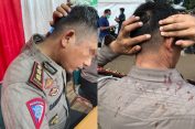 Membaik..!! AKBP Dermawan Karosekali Butuh Perawatan Khusus Usai Dikeroyok Pemuda Pancasila..!!