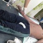 Erupsi Semeru..!! Puluhan Warga Alami Luka Bakar..!!