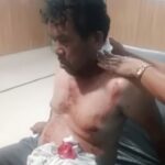 Sadiss..!! Preman Ngamuk di Siosar Karo, Petani Dibacoki, Ditikam, Hartanya Dibakar..!! Kuasa Hukum PT BUK: Kami tidak Pakai Preman..!!