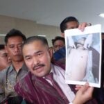 Ngeri Broo..!! Kamaruddin Simanjuntak: Hasil Autopsi Ulang Ada Luka Sayatan, Tulang dan Jari Brigadir J Patah..!!