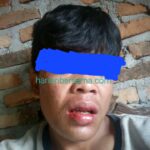 Ngerinya Premanisme di Deli Serdang..!! Anak di Bawah Umur Dikeroyok Empat Pria Dewasa..!! Dilapor ke Polresta DS, Pelaku Masih “Gentayangan”..!!