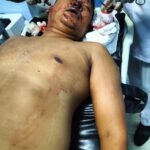 Ngeri Kali Laee..!! Ketepakk…Ketepukkk…Tentara “Mandi Darah” Dibantai OKP di Deli Serdang..!!