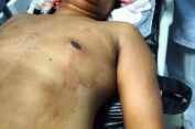 Ngeri Kali Laee..!! Ketepakk…Ketepukkk…Tentara “Mandi Darah” Dibantai OKP di Deli Serdang..!!