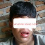 Ketakutan..!! Pelajar Korban Pengeroyokan Tujuh Preman Berhenti Sekolah, Hanya Satu Pelaku yang Ditangkap Polresta DS..!!