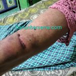 Lapor Pak Kapolda Sumut..!! Kasus “Anak Durhaka” Aniaya Ibu Kandung “Mandek” di Polres Labusel..!! Tagar Percuma Lapor Polisi Kembali Menggema..!!