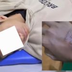 Ngerii..!! Diculik Senior, Siswa MAN 1 Medan Dipukuli, Dibakar, Dipaksa Makan Lumpur dan Minum Ludah Pelaku..!!