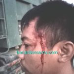 Biar Kelen Tau Ya Laee..!! Praduga “Koalisi Jahat” Polrestabes Medan-Kejari DS: Kasus Kepala Supir Ditembak “Lelet”, Perkara Godol Mirip “Super Jet”..!!