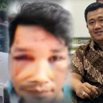 “Bobroknya” Kinerja Polsek Pancur Batu..!! Sebayang “Bonyok” Dihajar, Tersangka Josniko Tarigan Bebas Berkeliaran..!! Praktisi Hukum: Terduga Ada Persekongkolan Jahat..!!