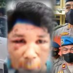 Percuma Lapor Polisi..!! Sebayang Babak Belur Dipukuli, Dua Tahun Kasusnya “Mati Suri”: Polsek Pancur Batu Terduga “Lindungi” Preman, Propam Mirip “Macan Ompong..!!
