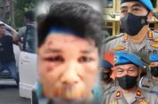 Percuma Lapor Polisi..!! Sebayang Babak Belur Dipukuli, Dua Tahun Kasusnya “Mati Suri”: Polsek Pancur Batu Terduga “Lindungi” Preman, Propam Mirip “Macan Ompong..!!