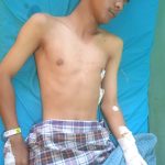Ngerii..!! Berhenti Kauu…Cess…Anak Medan Terkapar “Mandi Darah”, Tangan Nyaris Putus Ditebas Begal di Deli Serdang..!!