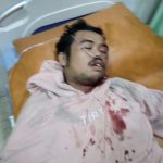 Awass…Medan Darurat Curanmor..!! Sepeda Motor Anak Wartawan Dicuri, Sempat Dikejar Malah Terkapar..!!