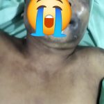 Terduga Dibunuh Polisi Medan..!! Warga Tewas dengan Mata, Pipi dan Dada Membiru, LIPPI Sumut: Kasat Reskrim Harus Tanggung Jawab..!!