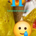 Siap-siap Kelen Yaa..!! Polda Sumut Siap Proses Hukum Kasus Dokter RS Mitra Sejati Potong Kaki Pasien..!!