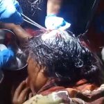 Prakk..!! Kepala Ibu Rumah Tangga Koyak Dikeroyok Tiga Pria, Pelaku Belum Ditangkap Polresta Deli Serdang..!!