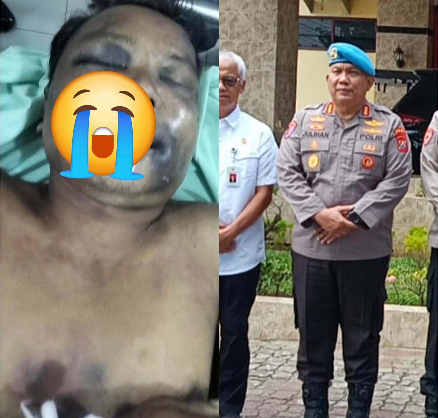 Polisi “Pembunuh” Dipecat tapi Masih Dinas..!! Ogah “Jeruk Makan Jeruk”, Kabid Propam Poldasu Irit Bicara, Kabid Humas Malah Bungkam..!!