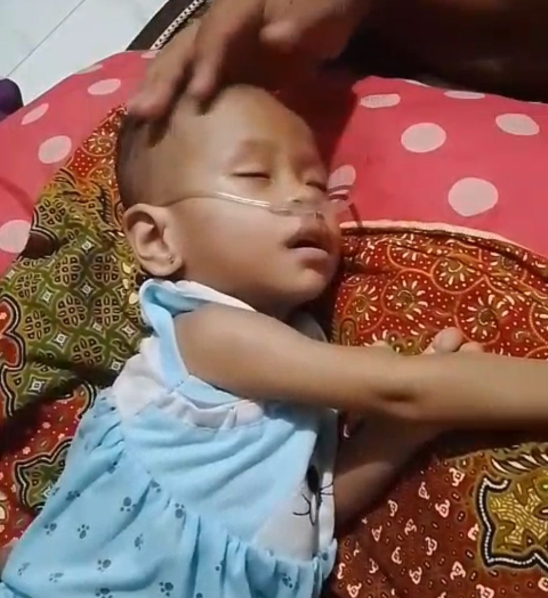 Bupati Deli Serdang Asyik Pencitraan, Warganya Kurang Gizi..!! LSM TKN Kenziro Sumut Peduli Bantu Balita Jantung Bocor di Sibiru-biru..!!