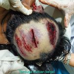 Awass..!! Polisi Sibuk Jual Beras, Kasus Begal dan Pembunuhan Meningkat di Wilayah Hukum Polrestabes Medan..!!