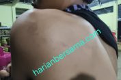 Ngerii..!! Mirip Film G 30 S PKI, ABG Patumbak Diangkut Tengah Malam Lalu Disiksa Satpol PP Deli Serdang, Badannya Dipukuli dan Disundut Api Rokok..!!