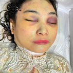 Eks Istri Polisi Tewas..!! Mata Lebam Dibilang Bunuh Diri, DPR Soroti Polrestabes Medan..!!