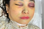 Eks Istri Polisi Tewas..!! Mata Lebam Dibilang Bunuh Diri, DPR Soroti Polrestabes Medan..!!